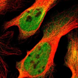KAT3B/p300 Antibody, Novus Biologicals:Antibodies:Primary Antibodies